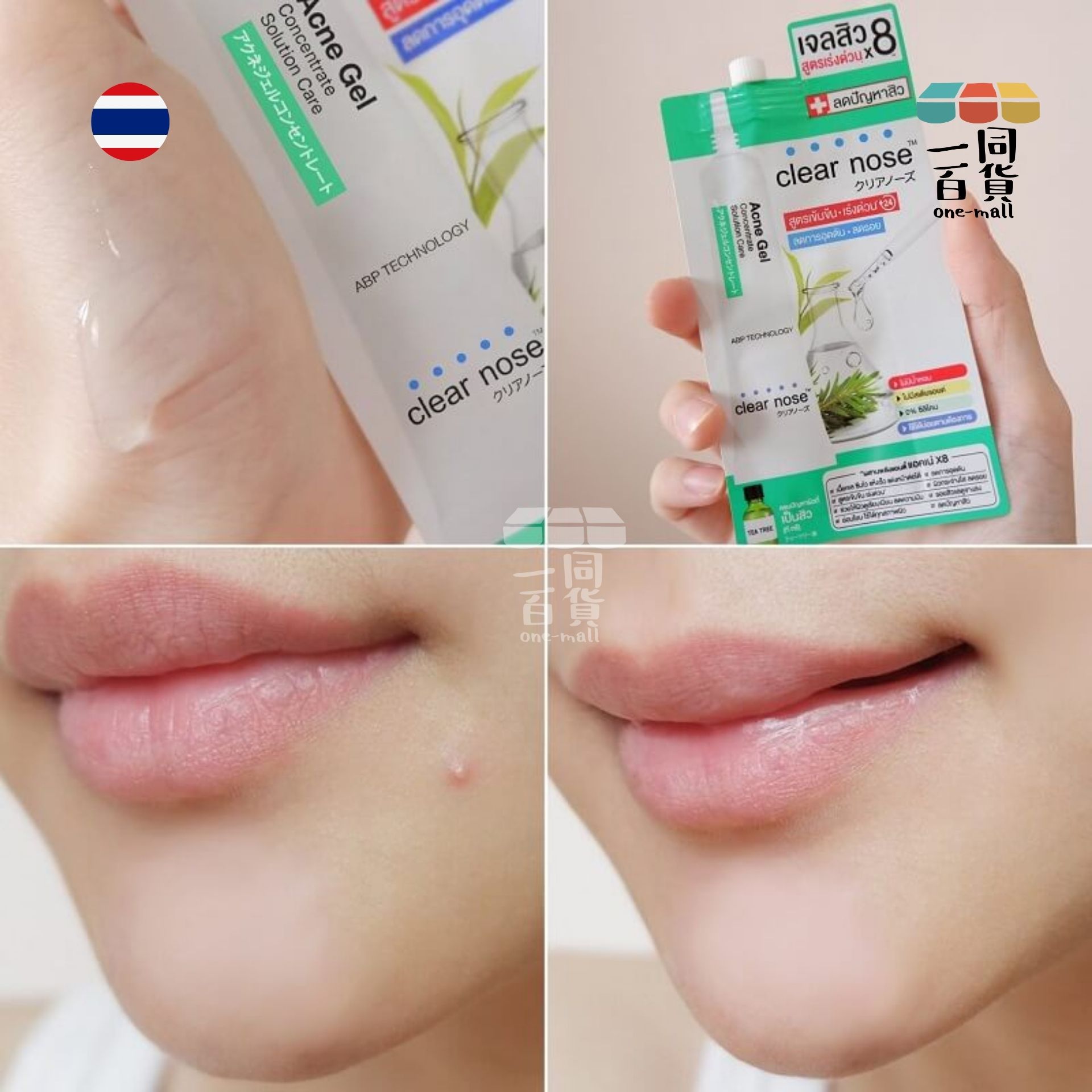 Clear Nose | Clear Nose - 濃縮抗痘修護暗瘡凝膠精華護理液 ABP複合配方 4g 綠 (平行進口) C243
